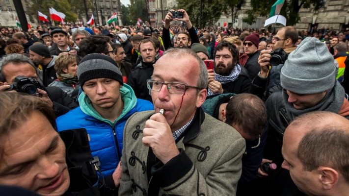 Historian Krisztián Ungváry was beat up by Prime Minister Viktor Orbán's supporters on Sunday. 